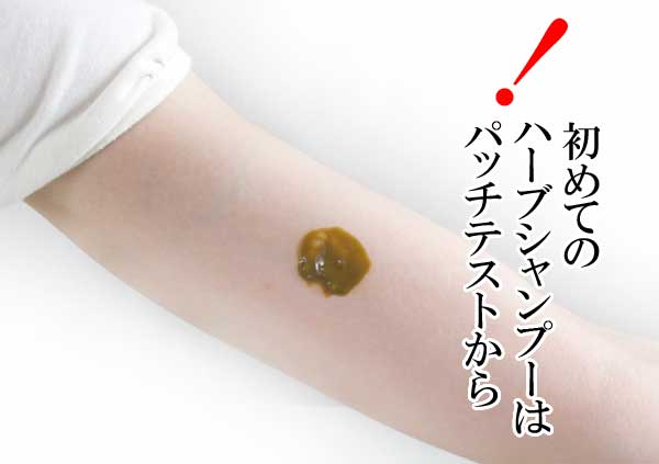 植物アレルギーの有無のチェック