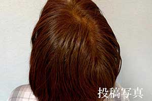 体験談