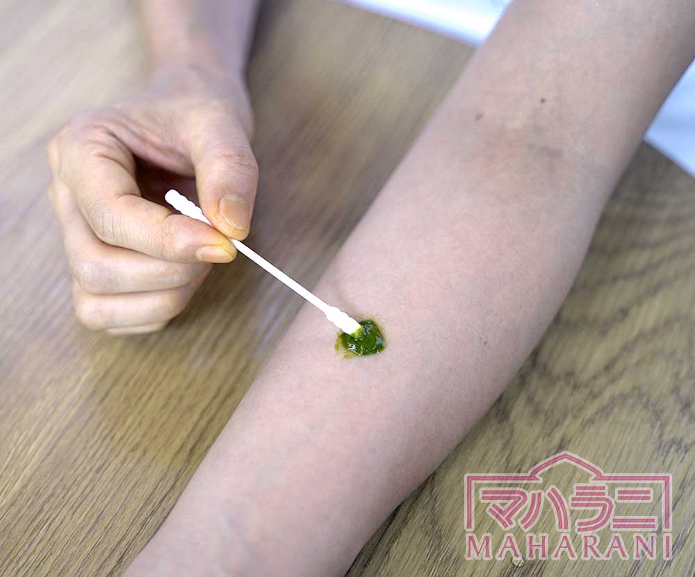 パッチテスト（皮膚アレルギー試験）